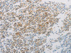 The image on the left is immunohistochemistry of paraffin-embedded Human tonsil tissue using CSB-PA988424 (ADM Antibody) at dilution 1/20, on the right is treated with synthetic peptide. (Original magnification: ×200)