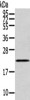 Gel: 12%SDS-PAGE, Lysate: 40 μg, , Primary antibody: CSB-PA239298 (RAB17 Antibody) at dilution 1/200 dilution, Secondary antibody: Goat anti rabbit IgG at 1/8000 dilution, Exposure time: 20 seconds