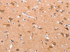 The image on the left is immunohistochemistry of paraffin-embedded Human brain tissue using CSB-PA783095 (APAF1 Antibody) at dilution 1/30, on the right is treated with synthetic peptide. (Original magnification: ×200)