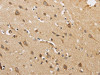 The image on the left is immunohistochemistry of paraffin-embedded Human brain tissue using CSB-PA129669 (ARF6 Antibody) at dilution 1/30, on the right is treated with synthetic peptide. (Original magnification: ×200)