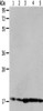 Gel: 8%SDS-PAGE, Lysate: 40 μg, Lane 1-5: Hela cells, 293T cells, mouse liver tissue, A431 cells, MCF7 cells, Primary antibody: CSB-PA129669 (ARF6 Antibody) at dilution 1/450, Secondary antibody: Goat anti rabbit IgG at 1/8000 dilution, Exposure time: 40 seconds