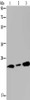 Gel: 10%SDS-PAGE, Lysate: 40 μg, Lane 1-2: Human fetal brain tissue, 293T cells, Primary antibody: CSB-PA643796 (RAB3c Antibody) at dilution 1/400, Secondary antibody: Goat anti rabbit IgG at 1/8000 dilution, Exposure time: 1 minute