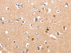 The image on the left is immunohistochemistry of paraffin-embedded Human brain tissue using CSB-PA219431 (RALB Antibody) at dilution 1/10, on the right is treated with synthetic peptide. (Original magnification: ×200)
