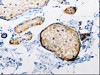 The image on the left is immunohistochemistry of paraffin-embedded Human skin tissue using CSB-PA443132 (RAB6A Antibody) at dilution 1/25, on the right is treated with synthetic peptide. (Original magnification: ×200)