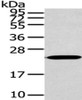 Gel: 12%SDS-PAGE, Lysate: 40 μg, , Primary antibody: CSB-PA569844 (ARL2 Antibody) at dilution 1/200 dilution, Secondary antibody: Goat anti rabbit IgG at 1/8000 dilution, Exposure time: 10 seconds