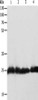 Gel: 10%SDS-PAGE, Lysate: 30 μg, Lane 1-4: Hela cells, NIH/3T3 cells, HepG2 cells, Mouse testis tissue, Primary antibody: CSB-PA558089 (RAN Antibody) at dilution 1/200, Secondary antibody: Goat anti rabbit IgG at 1/8000 dilution, Exposure time: 1 minute