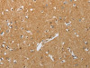 The image on the left is immunohistochemistry of paraffin-embedded Human brain tissue using CSB-PA442874 (RHEB Antibody) at dilution 1/25, on the right is treated with synthetic peptide. (Original magnification: ×200)