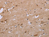 The image on the left is immunohistochemistry of paraffin-embedded Human brain tissue using CSB-PA104519 (ACVR2A Antibody) at dilution 1/20, on the right is treated with synthetic peptide. (Original magnification: ×200)