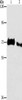 Gel: 6%SDS-PAGE, Lysate: 80 μg, Lane 1-2: Human fetal brain tissue, human lymphoma tissue, Primary antibody: CSB-PA924853 (ICOSLG Antibody) at dilution 1/100, Secondary antibody: Goat anti rabbit IgG at 1/8000 dilution, Exposure time: 10 minutes