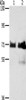 Gel: 6%SDS-PAGE, Lysate: 40 μg, Lane 1-2: Hela cells, Raji cells, Primary antibody: CSB-PA163656 (BRAF Antibody) at dilution 1/400, Secondary antibody: Goat anti rabbit IgG at 1/8000 dilution, Exposure time: 1 minute