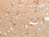 The image on the left is immunohistochemistry of paraffin-embedded Human brain tissue using CSB-PA041334 (CASP12 Antibody) at dilution 1/50, on the right is treated with synthetic peptide. (Original magnification: ×200)