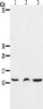 Gel: 15%SDS-PAGE, Lysate: 40 μg, Lane 1-3: Mouse lung tissue, Mouse thymus tissue, human fetal muscle tissue, Primary antibody: CSB-PA113746 (CCL17 Antibody) at dilution 1/1300, Secondary antibody: Goat anti rabbit IgG at 1/8000 dilution, Exposure time: 45 seconds Gel: 15%SDS-PAGE, Lysate: 40 μg, Lane 1-3: Mouse lung tissue, Mouse thymus tissue, human fetal muscle tissue, Primary antibody: CSB-PA113746 (CCL17 Antibody) at dilution 1/1300, Secondary antibody: Goat anti rabbit IgG at 1/8000 dilution, Exposure time: 45 seconds