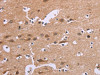 The image on the left is immunohistochemistry of paraffin-embedded Human brain tissue using CSB-PA952871 (CDK1 Antibody) at dilution 1/20, on the right is treated with synthetic peptide. (Original magnification: ×200)
