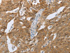 The image on the left is immunohistochemistry of paraffin-embedded Human tonsil tissue using CSB-PA981539 (CEBPA Antibody) at dilution 1/40, on the right is treated with synthetic peptide. (Original magnification: ×200)