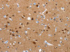 The image on the left is immunohistochemistry of paraffin-embedded Human brain tissue using CSB-PA695187 (CRMP1 Antibody) at dilution 1/15, on the right is treated with synthetic peptide. (Original magnification: ×200)