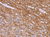 The image on the left is immunohistochemistry of paraffin-embedded Human brain tissue using CSB-PA033129 (CRH Antibody) at dilution 1/20, on the right is treated with synthetic peptide. (Original magnification: ×200)