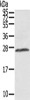 Gel: 12%SDS-PAGE, Lysate: 40 μg, , Primary antibody: CSB-PA990867 (AQP1 Antibody) at dilution 1/300 dilution, Secondary antibody: Goat anti rabbit IgG at 1/8000 dilution, Exposure time: 5 seconds