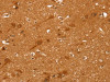 The image on the left is immunohistochemistry of paraffin-embedded Human brain tissue using CSB-PA098232 (CCND2 Antibody) at dilution 1/25, on the right is treated with synthetic peptide. (Original magnification: ×200)