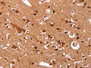 The image on the left is immunohistochemistry of paraffin-embedded Human brain tissue using CSB-PA975999 (CCND3 Antibody) at dilution 1/40, on the right is treated with synthetic peptide. (Original magnification: ×200)