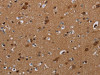 The image on the left is immunohistochemistry of paraffin-embedded Human brain tissue using CSB-PA580837 (DISC1 Antibody) at dilution 1/20, on the right is treated with synthetic peptide. (Original magnification: ×200) The image on the left is immunohistochemistry of paraffin-embedded Human brain tissue using CSB-PA580837 (DISC1 Antibody) at dilution 1/20, on the right is treated with synthetic peptide. (Original magnification: ×200)