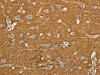 The image on the left is immunohistochemistry of paraffin-embedded Human brain tissue using CSB-PA109577 (SLC1A2 Antibody) at dilution 1/20, on the right is treated with synthetic peptide. (Original magnification: ×200)