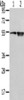 Gel: 8%SDS-PAGE, Lysate: 40 μg, Lane 1-2: TM4 cell and human placenta tissue, Primary antibody: CSB-PA064853 (SLC1A1 Antibody) at dilution 1/500 dilution, Secondary antibody: Goat anti rabbit IgG at 1/8000 dilution, Exposure time: 2 minutes