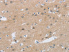 The image on the left is immunohistochemistry of paraffin-embedded Human brain tissue using CSB-PA285697 (C2orf40 Antibody) at dilution 1/20, on the right is treated with synthetic peptide. (Original magnification: ×200)