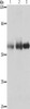 Gel: 10%SDS-PAGE, Lysate: 30 μg, Lane 1-3: Human cervical cancer tissue, Human legs fibrous histiocytoma, Human fetal brain tissue, Primary antibody: CSB-PA139246 (PVRL1 Antibody) at dilution 1/400, Secondary antibody: Goat anti rabbit IgG at 1/8000 dilution, Exposure time: 1 minute