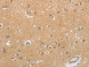 The image on the left is immunohistochemistry of paraffin-embedded Human brain tissue using CSB-PA551964 (GJB6 Antibody) at dilution 1/60, on the right is treated with synthetic peptide. (Original magnification: ×200)