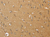 The image on the left is immunohistochemistry of paraffin-embedded Human brain tissue using CSB-PA299262 (EDNRA Antibody) at dilution 1/30, on the right is treated with synthetic peptide. (Original magnification: ×200)
