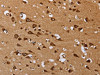 The image on the left is immunohistochemistry of paraffin-embedded Human brain tissue using CSB-PA980670 (EPOR Antibody) at dilution 1/40, on the right is treated with synthetic peptide. (Original magnification: ×200)