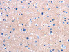The image on the left is immunohistochemistry of paraffin-embedded Human brain tissue using CSB-PA568435 (FPR2 Antibody) at dilution 1/25, on the right is treated with synthetic peptide. (Original magnification: ×200)