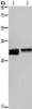Gel: 10%SDS-PAGE, Lysate: 40 μg, Lane 1-2: Hela cells, Jurkat cells, Primary antibody: CSB-PA569524 (FOSL1 Antibody) at dilution 1/615 dilution, Secondary antibody: Goat anti rabbit IgG at 1/8000 dilution, Exposure time: 20 seconds