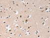 The image on the left is immunohistochemistry of paraffin-embedded Human brain tissue using CSB-PA291790 (GCG (GLP1) Antibody) at dilution 1/20, on the right is treated with synthetic peptide. (Original magnification: ×200)
