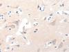 The image on the left is immunohistochemistry of paraffin-embedded Human brain tissue using CSB-PA996488 (GRM8 Antibody) at dilution 1/120, on the right is treated with synthetic peptide. (Original magnification: ×200)