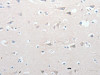 The image on the left is immunohistochemistry of paraffin-embedded Human brain tissue using CSB-PA929459 (GCH1 Antibody) at dilution 1/15, on the right is treated with synthetic peptide. (Original magnification: ×200)