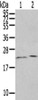Gel: 12%SDS-PAGE, Lysate: 40 μg, Lane 1-2: Human prostate tissue, Human adrenal gland tissue, Primary antibody: CSB-PA786046 (HINT3 Antibody) at dilution 1/200 dilution, Secondary antibody: Goat anti rabbit IgG at 1/8000 dilution, Exposure time: 2 minutes