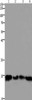 Gel: 10%SDS-PAGE, Lysate: 30 μg, Lane 1-4: 293T cells, hela cells, mouse lung tissue, Mouse brain tissue, Primary antibody: CSB-PA121578 (HMGB3 Antibody) at dilution 1/400, Secondary antibody: Goat anti rabbit IgG at 1/8000 dilution, Exposure time: 1.5 minutes