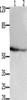 Gel: 10%SDS-PAGE, Lysate: 30 μg, Lane 1-2: 293T cells, hela cells, Primary antibody: CSB-PA201580 (API5 Antibody) at dilution 1/250, Secondary antibody: Goat anti rabbit IgG at 1/8000 dilution, Exposure time: 2 minutes