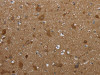 The image on the left is immunohistochemistry of paraffin-embedded Human brain tissue using CSB-PA290837 (PPP1R13L Antibody) at dilution 1/30, on the right is treated with synthetic peptide. (Original magnification: ×200)