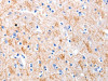 The image on the left is immunohistochemistry of paraffin-embedded Human brain tissue using CSB-PA595662 (KISS1 Antibody) at dilution 1/5, on the right is treated with synthetic peptide. (Original magnification: ×200)