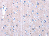 The image on the left is immunohistochemistry of paraffin-embedded Human brain tissue using CSB-PA140473 (LAMA3 Antibody) at dilution 1/10, on the right is treated with synthetic peptide. (Original magnification: ×200)