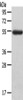 Gel: 8%SDS-PAGE, Lysate: 40 μg, , Primary antibody: CSB-PA172061 (LAG3 Antibody) at dilution 1/148 dilution, Secondary antibody: Goat anti rabbit IgG at 1/8000 dilution, Exposure time: 3 minutes