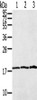 Gel: 12%SDS-PAGE, Lysate: 40 μg, Lane 1-3: Raw264.7, 231 cells, Raji cells, Primary antibody: CSB-PA016594 (LAIR2 Antibody) at dilution 1/400, Secondary antibody: Goat anti rabbit IgG at 1/8000 dilution, Exposure time: 5 minutes