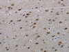 The image on the left is immunohistochemistry of paraffin-embedded Human brain tissue using CSB-PA313669 (LAIR2 Antibody) at dilution 1/20, on the right is treated with synthetic peptide. (Original magnification: ×200)