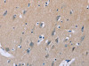 The image on the left is immunohistochemistry of paraffin-embedded Human brain tissue using CSB-PA939111 (LIFR Antibody) at dilution 1/30, on the right is treated with synthetic peptide. (Original magnification: ×200)