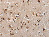 The image on the left is immunohistochemistry of paraffin-embedded Human brain tissue using CSB-PA219638 (LAMA1 Antibody) at dilution 1/70, on the right is treated with synthetic peptide. (Original magnification: ×200)