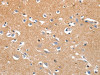 The image on the left is immunohistochemistry of paraffin-embedded Human brain tissue using CSB-PA288262 (LRP3 Antibody) at dilution 1/80, on the right is treated with synthetic peptide. (Original magnification: ×200)