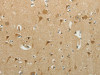 The image on the left is immunohistochemistry of paraffin-embedded Human brain tissue using CSB-PA232265 (MCM4 Antibody) at dilution 1/40, on the right is treated with synthetic peptide. (Original magnification: ×200)