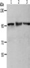 Gel: 8%SDS-PAGE, Lysate: 50 μg, Lane 1-3: NIH/3T3 cells, Hela cells, K562 cells, Primary antibody: CSB-PA232265 (MCM4 Antibody) at dilution 1/700, Secondary antibody: Goat anti rabbit IgG at 1/8000 dilution, Exposure time: 10 seconds